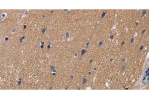Immunohistochemistry of paraffin-embedded Human brain tissue using KCNJ11 Polyclonal Antibody at dilution 1:40