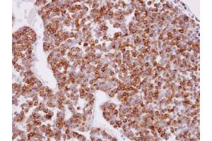 IHC-P Image Immunohistochemical analysis of paraffin-embedded human pituitary gland tumor, using XPR1, antibody at 1:100 dilution. (xpr1 antibody  (N-Term))