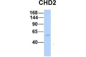Host:  Rabbit  Target Name:  CHD2  Sample Type:  Human Fetal Muscle  Antibody Dilution:  1. (CHD2 antibody  (N-Term))