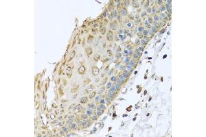Immunohistochemistry of paraffin-embedded human esophagus using ARFGAP3 antibody (ABIN5974520) at dilution of 1/100 (40x lens). (ARFGAP3 antibody)
