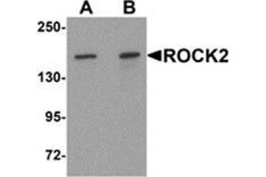 Western blot analysis of ROCK2 in mouse brain tissue lysate with ROCK2 antibody at (A) 1 and (B) 2 μg/ml