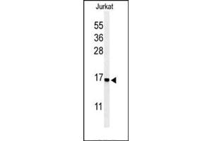 Western blot analysis in Jurkat cell line lysates (35 ug/lane) using RPS25 Antibody (N-term) Cat. (RPS25 antibody  (N-Term))