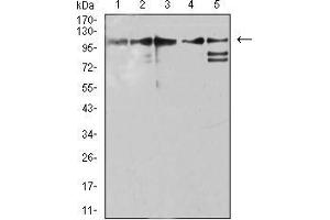 Western blot analysis using ZFP91 mouse mAb against Jurkat (1), A431 (2), HepG2 (3), HEK293 (4), and A549 (5) cell lysate. (ZFP91 antibody  (AA 162-304))