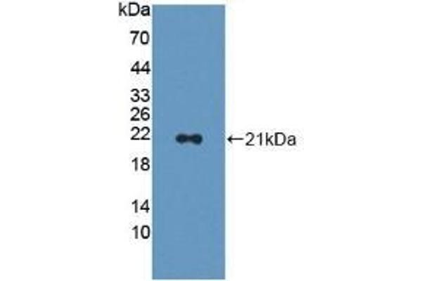 CAP2 抗体  (AA 317-455)