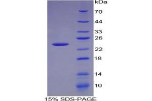 SDS-PAGE analysis of Mouse CXCL15 Protein. (Chemokine (C-X-C Motif) Ligand 15 (CXCL15) Protein)