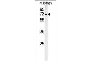 Western blot analysis in mouse kidney tissue lysates (35ug/lane). (GNE antibody  (C-Term))