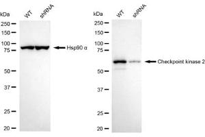 Western blotting analysis using Checkpoint kinase 2 antibody (ABIN7798039). (Recombinant CHEK2 antibody)
