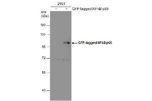 WB Image Non-transfected (–) and transfected (+) 293T whole cell extracts (30 μg) were separated by 7. (NF-kB p65 antibody  (Center))
