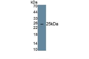Detection of Recombinant ANGPTL8, Human using Monoclonal Antibody to Angiopoietin Like Protein 8 (ANGPTL8) (C19ORF80 antibody  (AA 24-196))