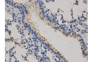 Immunohistochemistry (IHC) image for anti-Carcinoembryonic Antigen-Related Cell Adhesion Molecule 3 (CEACAM3) antibody (ABIN1871781) (CEACAM3 antibody)