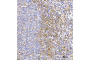 IHC analysis of Hamartin/TSC1 using anti-Hamartin/TSC1 antibody (ABIN7599499). (TSC1 antibody  (AA 1-618))
