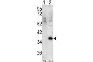 Western Blotting (WB) image for anti-Docking Protein 4 (DOK4) antibody (ABIN3003434) (DOK4 antibody)