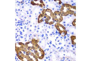 Immunohistochemistry of paraffin-embedded rat kidney using KRT19 antibody. (Cytokeratin 19 antibody)