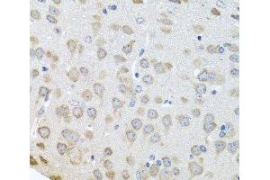 Immunohistochemistry of paraffin-embedded Mouse brain using Polyclonal AntibodyPC4 Polyclonal Antibody at dilution of 1:100 (40x lens). (SUB1 antibody)