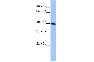 WB Suggested Anti-TSPAN17 Antibody Titration:  0. (Tetraspanin 17 antibody  (N-Term))