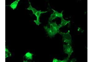 Image no. 2 for anti-PTK7 Protein tyrosine Kinase 7 (PTK7) antibody (ABIN1497127) (PTK7 antibody)