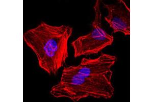 Immunofluorescence analysis of HeLa cells. (Cytokeratin 5 antibody)