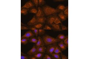 Immunofluorescence analysis of U-2 OS cells using [KO] GIT1 antibody (ABIN7267383) at dilution of 1:100.