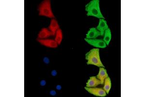 ABIN7093138 and ABIN7100420 staining Hela cells by IF/ICC. (FAM35A/B antibody)