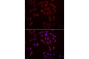 Immunofluorescence analysis of A549 cells using FRZB antibody (ABIN5973961). (FRZB antibody)