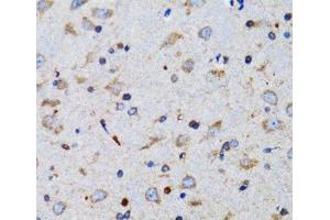 Immunohistochemistry of paraffin-embedded Mouse brain using TNFSF12 Polyclonal Antibody at dilution of 1:100 (40x lens). (TWEAK antibody)