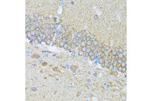 Immunohistochemistry of paraffin-embedded mouse brain using CASP3 antibody. (Caspase 3 antibody)