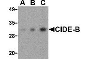 Western Blotting (WB) image for anti-Cell Death-Inducing DFFA-Like Effector B (CIDEB) (Middle Region) antibody (ABIN1030906)