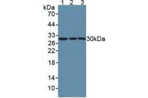 Figure. (NNMT antibody  (AA 1-258))