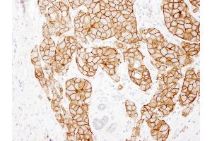 Immunohistochemistry (IHC) image for anti-Receptor tyrosine-protein kinase erbB-2 (ErbB2/Her2) (C-Term) antibody (ABIN7448962) (ErbB2/Her2 antibody  (C-Term))