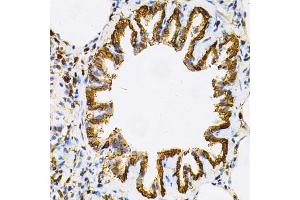 Immunohistochemistry of paraffin-embedded rat lung using HSP90AB1 Antibody (ABIN5970445) at dilution of 1/100 (40x lens). (HSP90AB1 antibody)