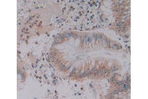 Figure. (GFPT2 antibody  (AA 2-288))