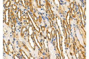ABIN6262388 and ABIN6266563 at 1/100 staining Rat kidney tissue by IHC-P.