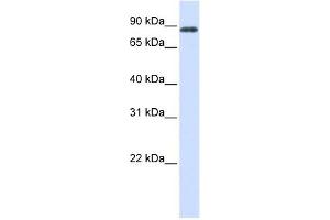 HECTD2 antibody used at 1 ug/ml to detect target protein. (HECTD2 antibody  (C-Term))
