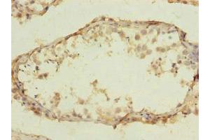Immunohistochemistry of paraffin-embedded human testis tissue using  at dilution of 1:100 (CLEC4C antibody  (AA 45-213))
