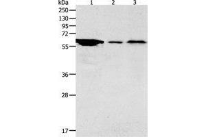Western Blotting (WB) image for anti-Adenylate Cyclase Activating Polypeptide 1 (Pituitary) Receptor Type I (ADCYAP1R1) antibody (ABIN1870813) (ADCYAP1R1 antibody)