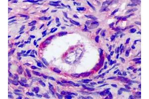 Human Ovary: Formalin-Fixed, Paraffin-Embedded (FFPE) (FSHR antibody  (Internal Region))