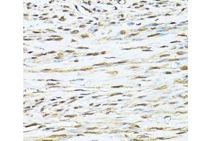 Immunohistochemistry of paraffin-embedded Human uterus using KU70 Polyclonal Antibody at dilution of 1:100 (40x lens). (XRCC6 antibody)