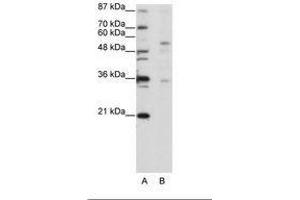 Image no. 1 for anti-Zinc Finger Protein 57 (ZFP57) (C-Term) antibody (ABIN202756) (ZFP57 antibody  (C-Term))