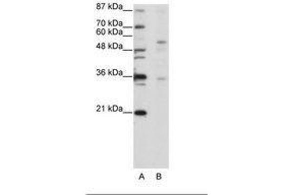ZFP57 antibody  (C-Term)