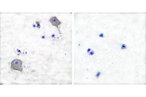 Peptide - +Immunohistochemical analysis of paraffin-embedded human brain tissue using Claudin 5 antibody (#C0145). (Claudin 5 antibody)