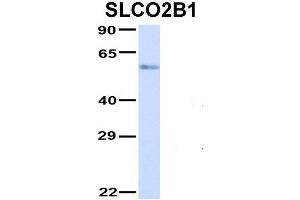 Western Blotting (WB) image for anti-Solute Carrier Organic Anion Transporter Family, Member 2B1 (SLCO2B1) (N-Term) antibody (ABIN2781627)