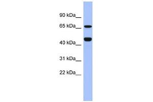 WB Suggested Anti-ZNF713 Antibody Titration:  0.