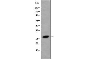 Western blot analysis of HOXB8 using LOVO whole cell lysates (HOXB8 antibody  (Internal Region))