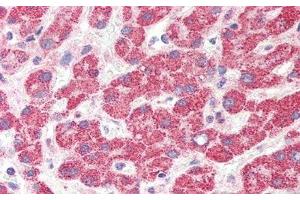 Detection of HAO1 in Human Liver Tissue using Polyclonal Antibody to Hydroxyacid Oxidase 1 (HAO1) (HAO1 antibody  (AA 113-369))