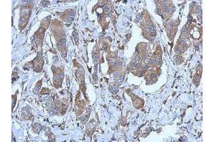 Image no. 1 for anti-Purinergic Receptor P2X, Ligand Gated Ion Channel 2 (P2RX2) (AA 8-302) antibody (ABIN1499950) (P2RX2 antibody  (AA 8-302))