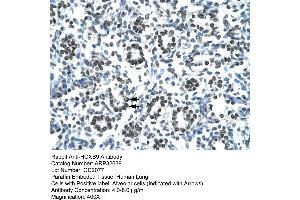 Human Lung (HOXB9 antibody  (N-Term))