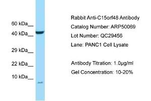 Western Blotting (WB) image for anti-Chromosome 15 Open Reading Frame 48 (C15ORF48) (N-Term) antibody (ABIN2784037) (NMES1 antibody  (N-Term))