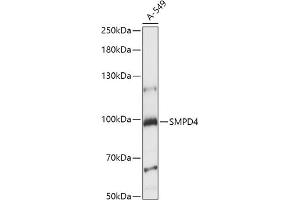 Western blot analysis of extracts of A-549 cells, using SMPD4 antibody (ABIN7270531) at 1:1000 dilution. (SMPD4 antibody  (AA 600-800))