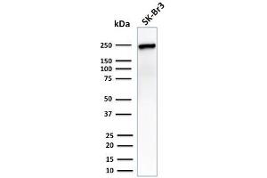 Western Blot Analysis of SK-Br3 cell lysate using CHD4 Mouse Monoclonal Antibody (3F2/4). (CHD4 antibody  (C-Term))