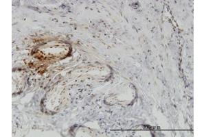 Image no. 1 for anti-Twinfilin, Actin-Binding Protein 1 (TWF1) (AA 80-252) antibody (ABIN465966) (TWF1 antibody  (AA 80-252))